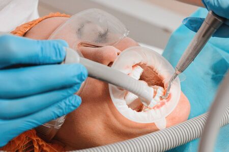 The patient visits the dentist for a dental ultrasound procedure at a dental clinic.2020の写真素材