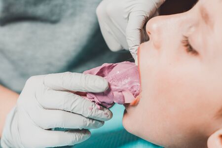 Registration of impressions and bites in a young teenager. Functional modern dental diagnostics 2020の写真素材