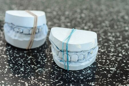 Gypsum model of a human jaw with teeth, made in a dental laboratory 2020