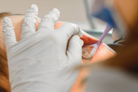 The boy examined by an orthodontist, he opened his mouth wide and the dentist examined his teeth.2020の写真素材