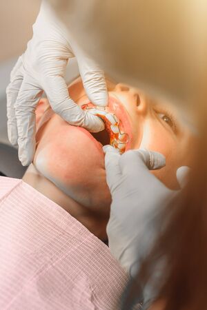 The boy with his mouth open lies in the dentist's chair while the orthodontist holds the plate on...