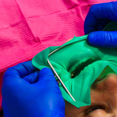 Installation of a cofferdam to the patient, modern dental equipment, treatment in sterile...