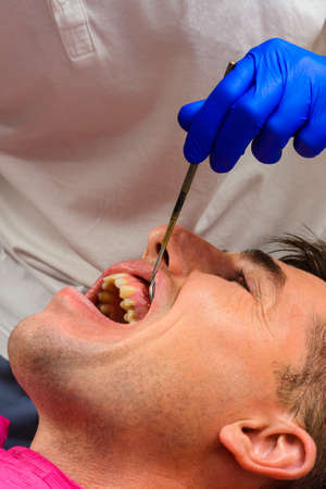 Visiting the dentist, the dentist evaluates the oral cavity and identifies problem areas of the teeth. Fistula mouth.の写真素材