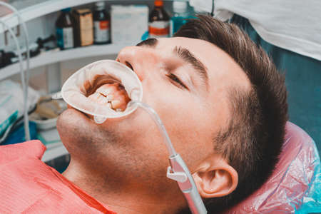 The procedure at the dentist, the dentist prepares the patient and tools to remove tartar, saliva ejector and retractor in the patient's mouth.の写真素材