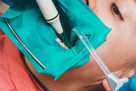 Treatment of posterior tooth, mouth covered with rubber dam, sterile treatment with modern technology. 2020の写真素材