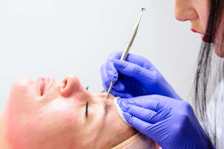 Mechanical facial cleansing, skin cleansing procedure from surface and deep impurities. new
