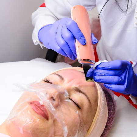 Cleansing the face from keratinized epithelium, excess fat, blockages of the sebaceous glands,...