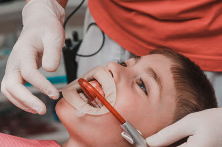 The child sits in a dental chair, saliva ejector in the mouth, caries treatment in a child,...