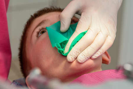 The dentist installs a rubber dam and a clamp for the treatment of a diseased tooth, the boy is sitting in a dental chair.の写真素材