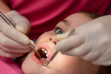 The pediatric dentist treats the child's teeth, examination of the tooth after cleaning from caries.の素材 [FY310181750068]