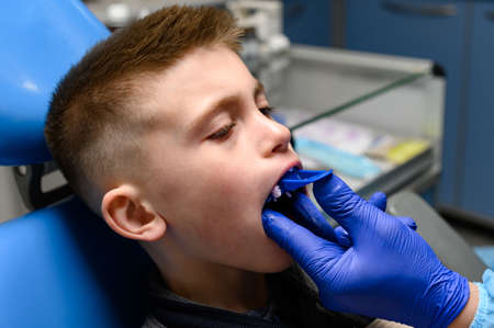 Jaw impression with a silicone diagnostic model, crooked teeth in a child, a visit to the orthodontist.の写真素材