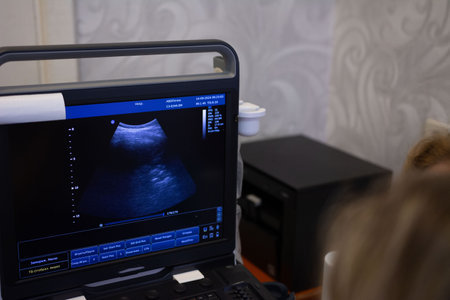 A portable ultrasound machine displays an abdominal scan of internal organs in a clinical setting. The screen features a complex image used for medical diagnostics, aiding in medical evaluations.の写真素材