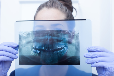 Dentist and assistant examining x-ray togetherの写真素材