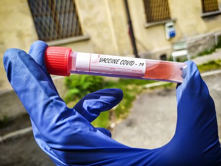 Test Tube used for the coronavirus treatment