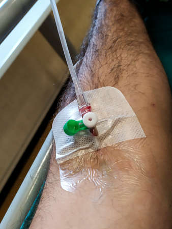 Detail of a medical drip in an arm