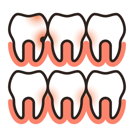 Toothache and paradontosis symbol  isolated on white backgroundのイラスト素材