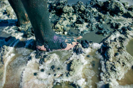 Therapeutic mud. Mud foot treatment. Arthritis and Arthrosis Treatment.