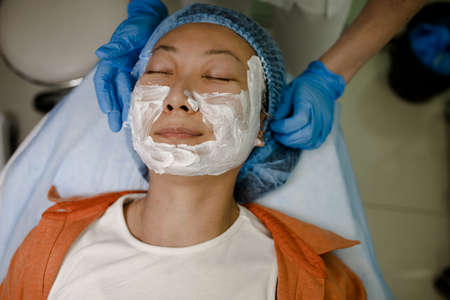 Face Having A Laser Skin Treatment, A Resurfacing Technique For Wrinklesの写真素材