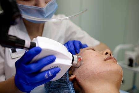 Doctor Cosmetologist Does The Procedure Of Laser Resurfacing Of The Face.の写真素材