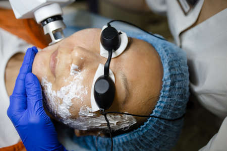 Face Having A Laser Skin Treatment, A Resurfacing Technique For Wrinklesの写真素材