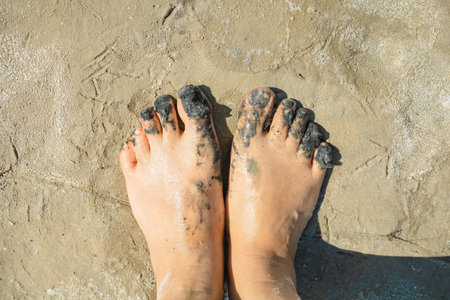 Therapeutic mud. Mud foot treatment. Arthritis and Arthrosis Treatment.