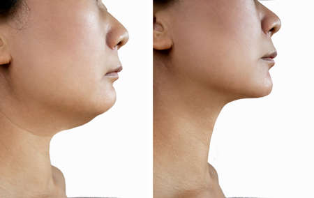 Part of face, woman with double and perfect chin isolated on white background Beauty concept.