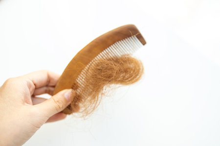 Hair loss in the comb, hair loss every day is a serious problem, on a white background.の写真素材