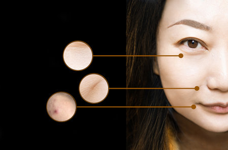 Close-up of wrinkles and skin imperfections on the face of an Asian woman. Portrait of a beautiful woman touching her perfect skin after a cosmetic procedure. Aging process conceptの写真素材