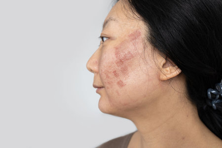 A face of Asian woman who had facial skin treatment by Co2 laser to treat her Acne Scars to get face smooth. Laser can solve this problemの写真素材