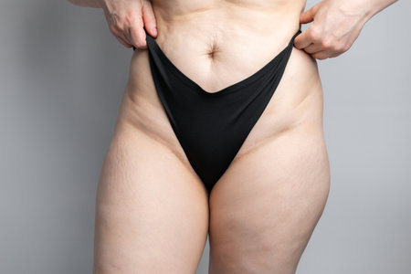 Legs of a woman with cellulite, isolated on white backgroundの写真素材