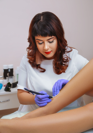 Removal, coagulation of vessels on the legs.の写真素材