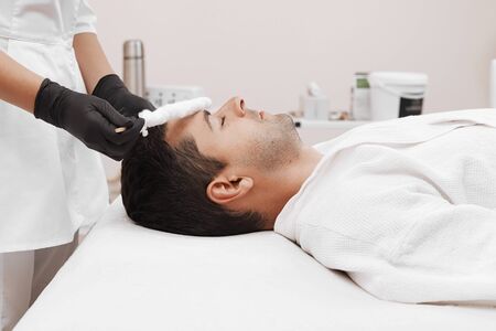 Liquid nitrogen therapy.の写真素材