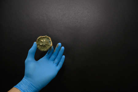 A male hand in a blue sterilized medical glove holds a spoiled moldy lemon. Black background. Copy...