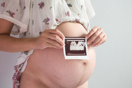 Closeup pregnant woman holding ultrasound scan.