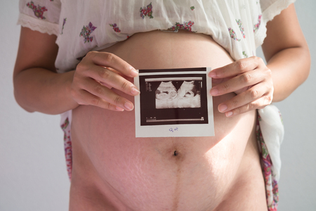 Closeup pregnant woman holding ultrasound scan.
