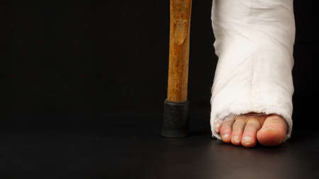 Close up of ankle in plaster cast and crutch on black background with copy spaceの写真素材