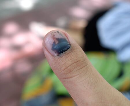 Fingers from being injured scissor doors の写真素材