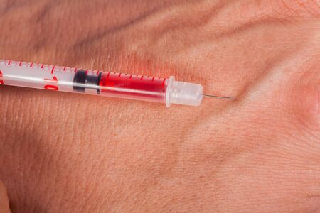 Subcutaneous medical injection concept with a small hypodermic syringe filled with a red liquid penetrating the skin and producing a flow of dripping blood in a close up viewの写真素材