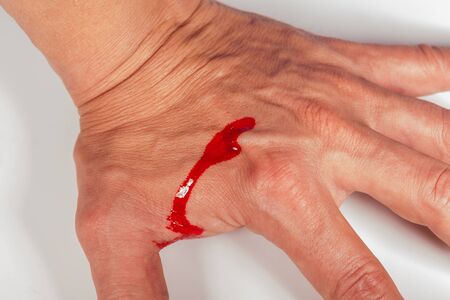 Subcutaneous medical injection concept with a small hypodermic syringe filled with a red liquid...