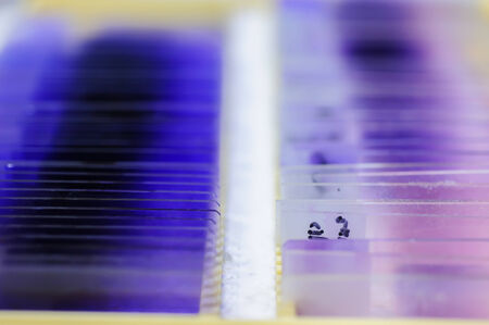 blood testing in laboratory for microscopeの写真素材