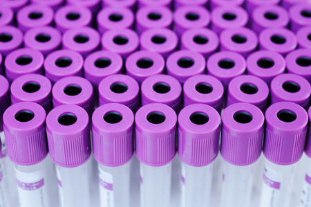 blood testing in laboratory