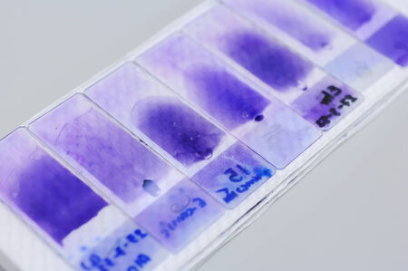 blood testing in laboratory for microscope 
