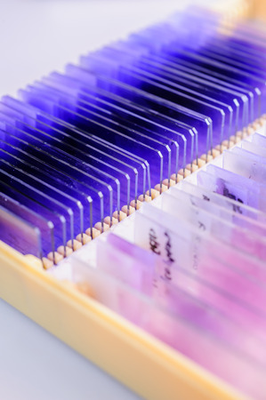 blood testing in laboratory for microscope 