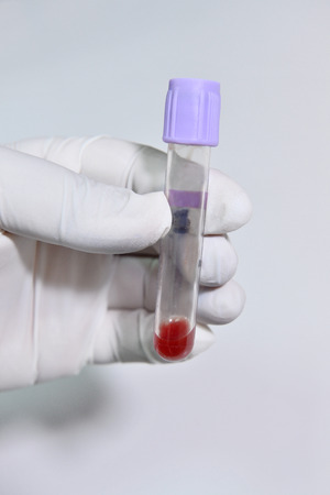 Blood test tube in a laboratoryの写真素材