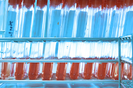 blood testing in laboratory take with art lighting and blue filterrの写真素材