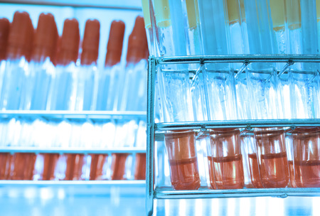 blood testing in laboratory take with art lighting and blue filter