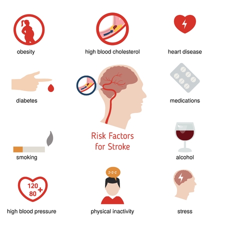 Infographics for stroke. Stroke risk factors. Vector illustration.のイラスト素材