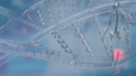 Knee pain refers to discomfort or pain that is experienced in the knee joint or surrounding area.の写真素材