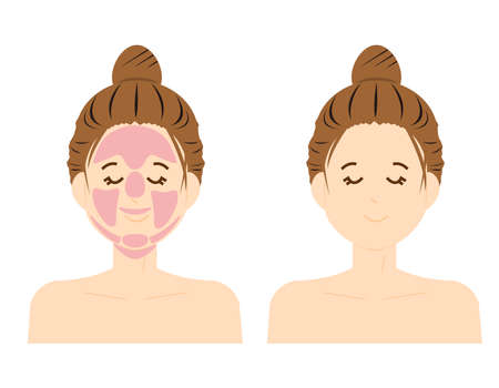 Female face. Hair loss location. Vector illustration.のイラスト素材