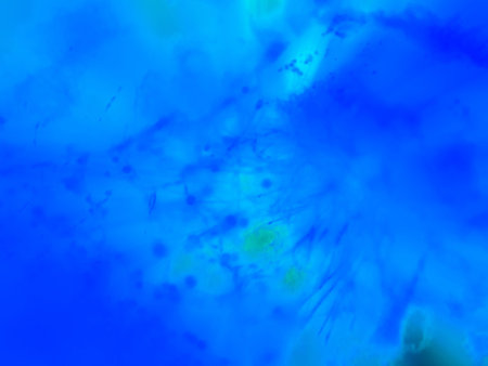 The decorative abstract background blur and zoom. A lot of color and light.